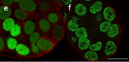 Performance of the grid confocal microscope