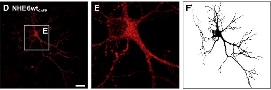 Mouse primary hippocampal neurons