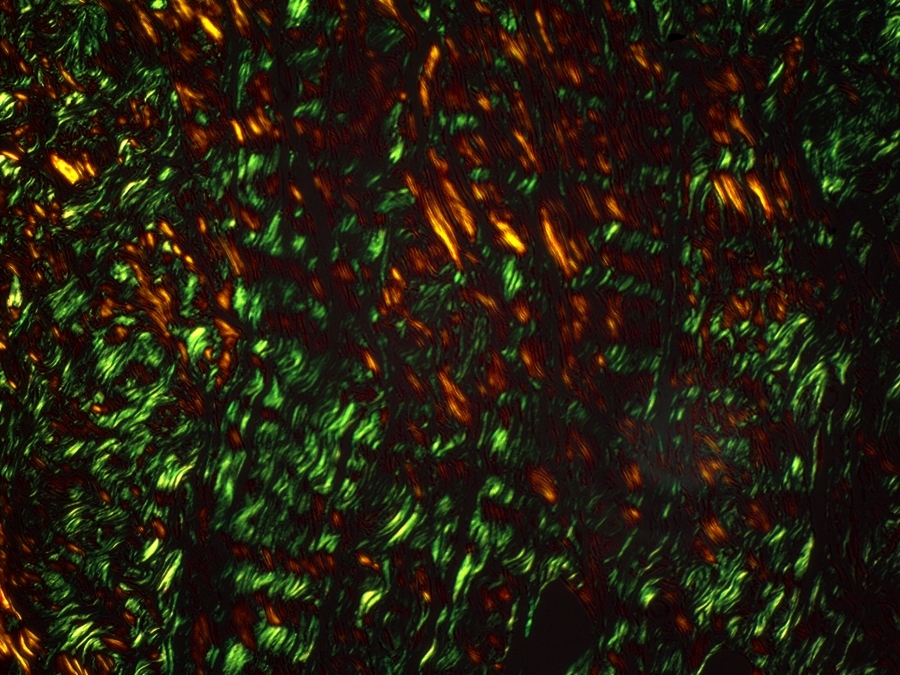 Polarization microscopy of tissue