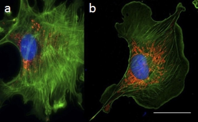 Comparison of 3D imaging techniques