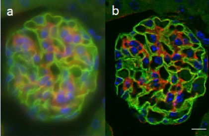 Performance of the grid confocal microscope