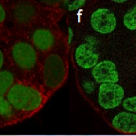 Performance of the grid confocal microscope