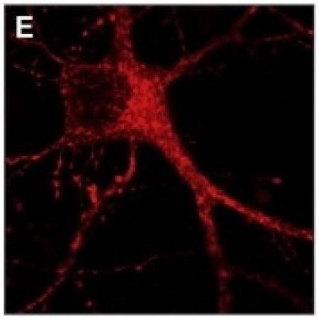 Mouse primary hippocampal neurons