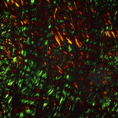 Polarization microscopy of tissue