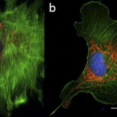 Comparison of 3D imaging techniques