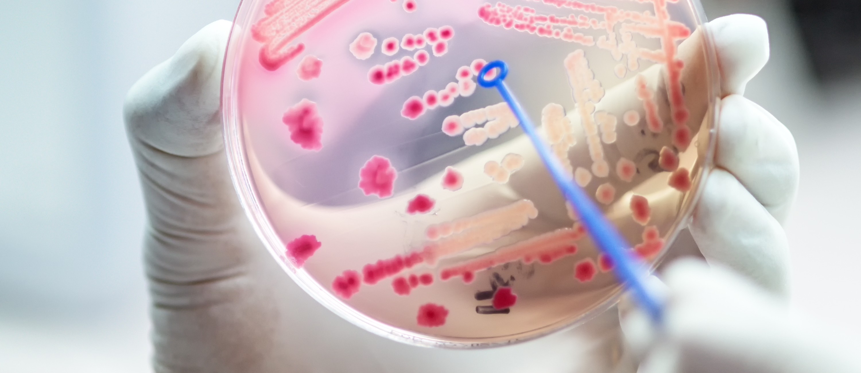 Lactose fermentation positive cells on MacConkey Agar.