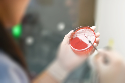 Antimicrobial image on blood agar