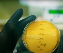 Antibiotic resistant bacteria on agar test plate