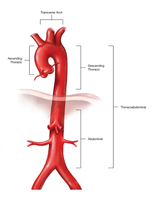 Aortic Disease