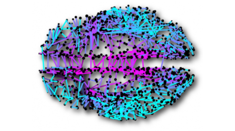 Brain with connective pathways