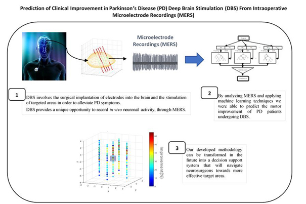 Prediction of Clinical Improvement in Parkinson's Disease (PD) Deep Brain Stimulation (DBS) from Intraoperative Microelectrode Reocrdings (MERS)