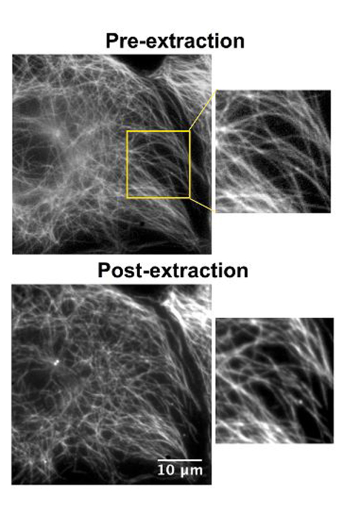 In this figure, the MT cytoskeleton is shown in a living cell (pre-extraction) and after the extraction treatment (post-extraction), using SiR-tubulin (Spirochrome). 