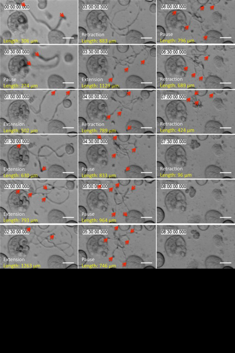 Figure from article: Released proplatelets can elongate, pause, and retract. Representative time-lapse differential interference contrast microscopy: released proplatelets in static tissue culture elongate, pause, and retract over time. Scale bar is 10 µm. Red arrows indicate proplatelet tips.