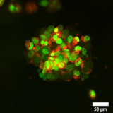 Image of breast cancer spheroid grown in a 3D tissue-like matrix after 15 days of culture. The green channel corresponds to the green fluorescent protein (GFP) expressed in the cell’s nucleus. The red channel corresponds to the fluorescence from a chemotherapeutical drug interacting with the spheroid.  