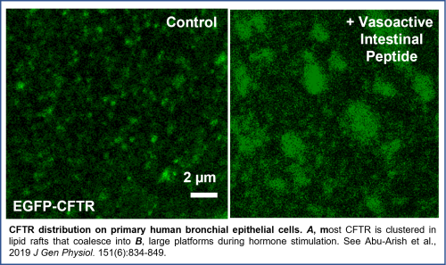 CFTRC in lipid rafts and platforms