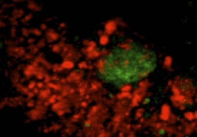 Confocal Laser Scanning Microscope images of two types of 
