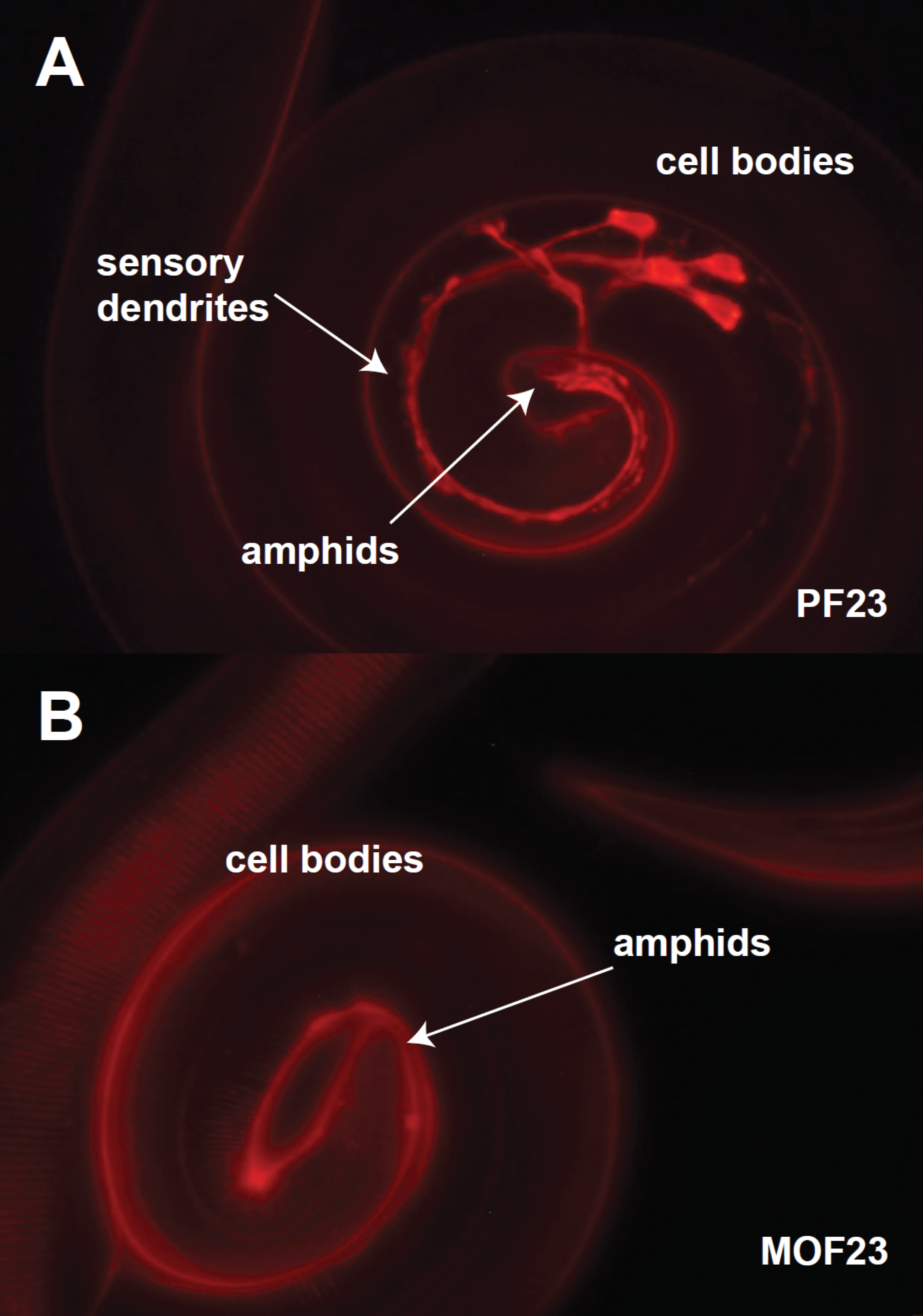 Top panel shows an H. contortus parasite with amphid sensory neurons stained red. Bottom panel shows a drug resistant worm, same treatment, but no staining of neurons.