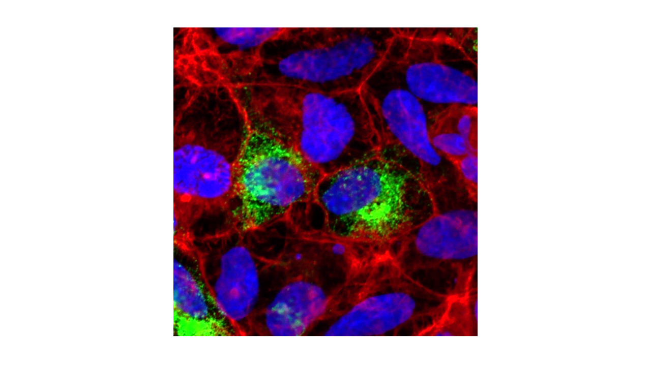 Intracellular localization of MGP (green) lacking the conserved serine residues. Actin filaments and nuclei are stained in red and blue, respectively.