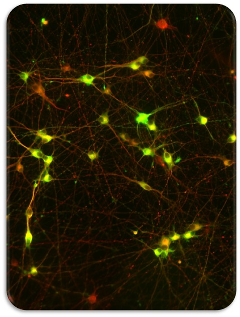 Photo of fluorescently marked dopaminergic neurons