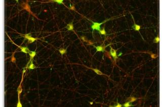 Photo of fluorescently marked dopaminergic neurons