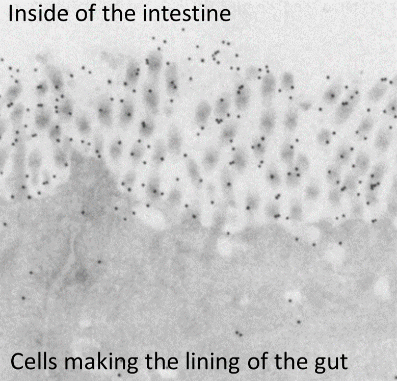 Electron micrograph of the lining of the gut showing CEA (black dots) as adhesion cells residing at the extremities of the cells that make up the lining of the gut.