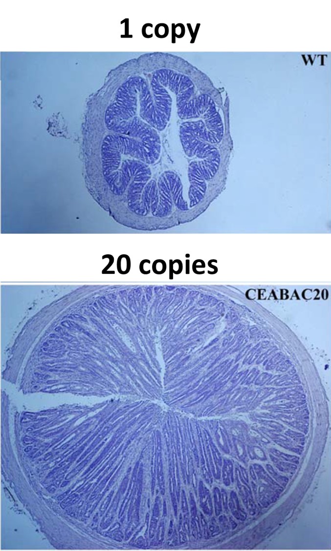 Cross-sections of a mice colons, comparing wild-type mice with transgenic mice in which 20 copies of the human CEA/CEACAM6 was inserted.