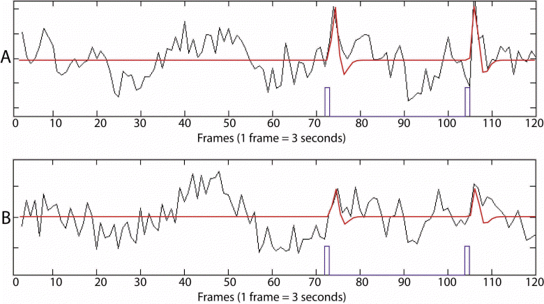 Examples of BOLD signal in a single voxel (5x5x5mm of brain tissue) during a 6 minute scan of 120 measurements (frames).