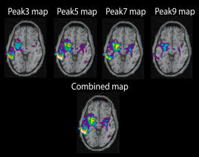 Note the activation on the right side of this image is strongest peak7, while the left sided activation is strongest in peak5. This is a good example of an activation that is optimized by the use of more than one model HRF.