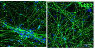 Fluorescent microscopy images in blue (Hoescht staining) and green (TUBB3 staining) showing a cluster of nerve cells in the panel on the left, and nerve cells growing evenly over the surface on the right.