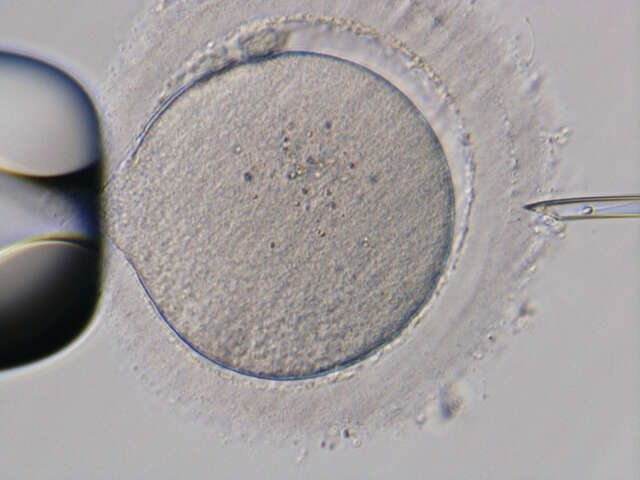 Microscopic image of in vitro fertilization
