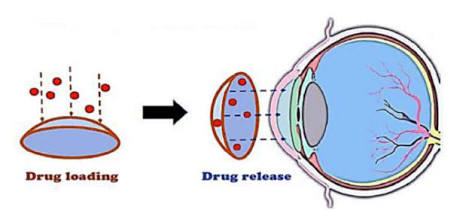 Mechanism explaining drug delivery of contact lenses
