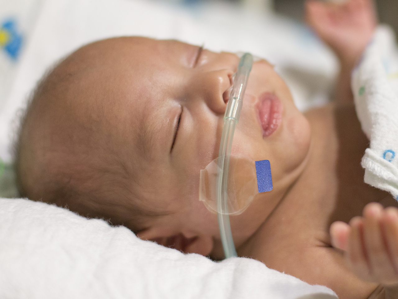 Baby With Nasal Prongs