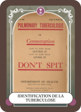 Identification de la tuberculose
