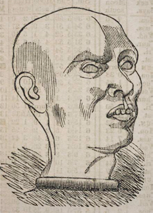 “Johnson the Murderer,” from The Phrenological Almanac for 1841, by L.N. Fowler. (New York; Philadelphia; Boston, 1841). Osler Library (Almanac Collection), Fowler 1841.