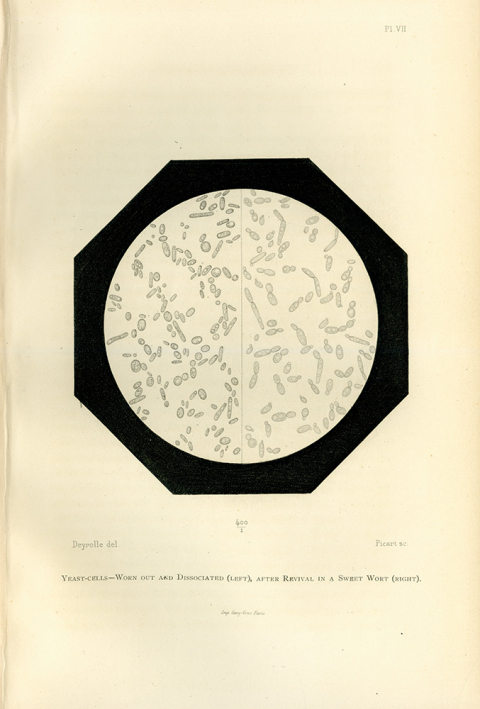 Illustration showing what healthy and worn-out yeast cells look like when viewed through a microscope. Illustration from Pasteur's Études sur la Bière (Studies on Beer),1876.