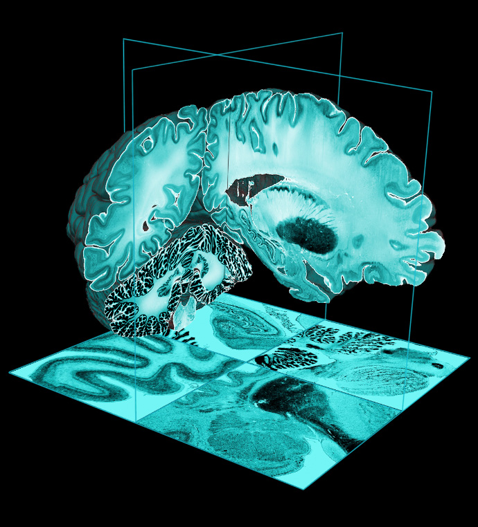 A segment of the Big Brain atlas