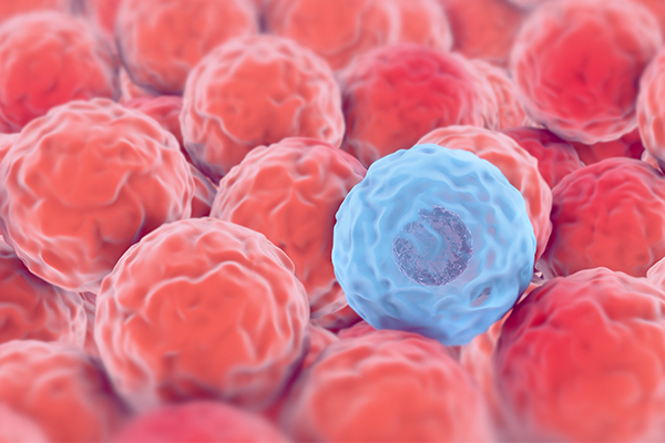 A single blue cell surrounded by cells of a different colour