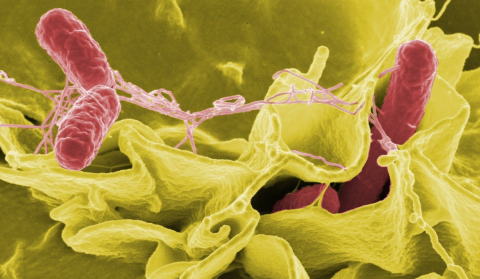 Color-enhanced scanning electron micrograph showing Salmonella Typhimurium invading cultured human cells