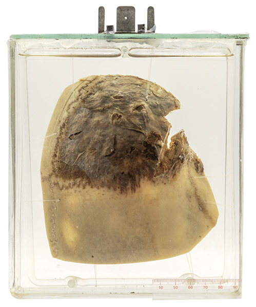 09 Pathology specimen