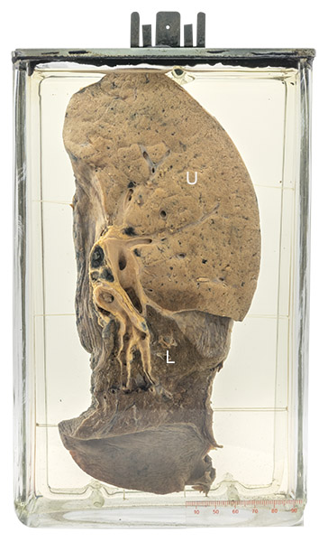 10 pathology specimen