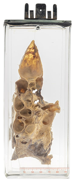 14 Pathology specimen