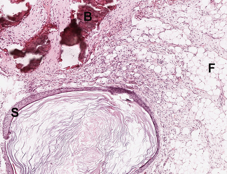 Histology slide