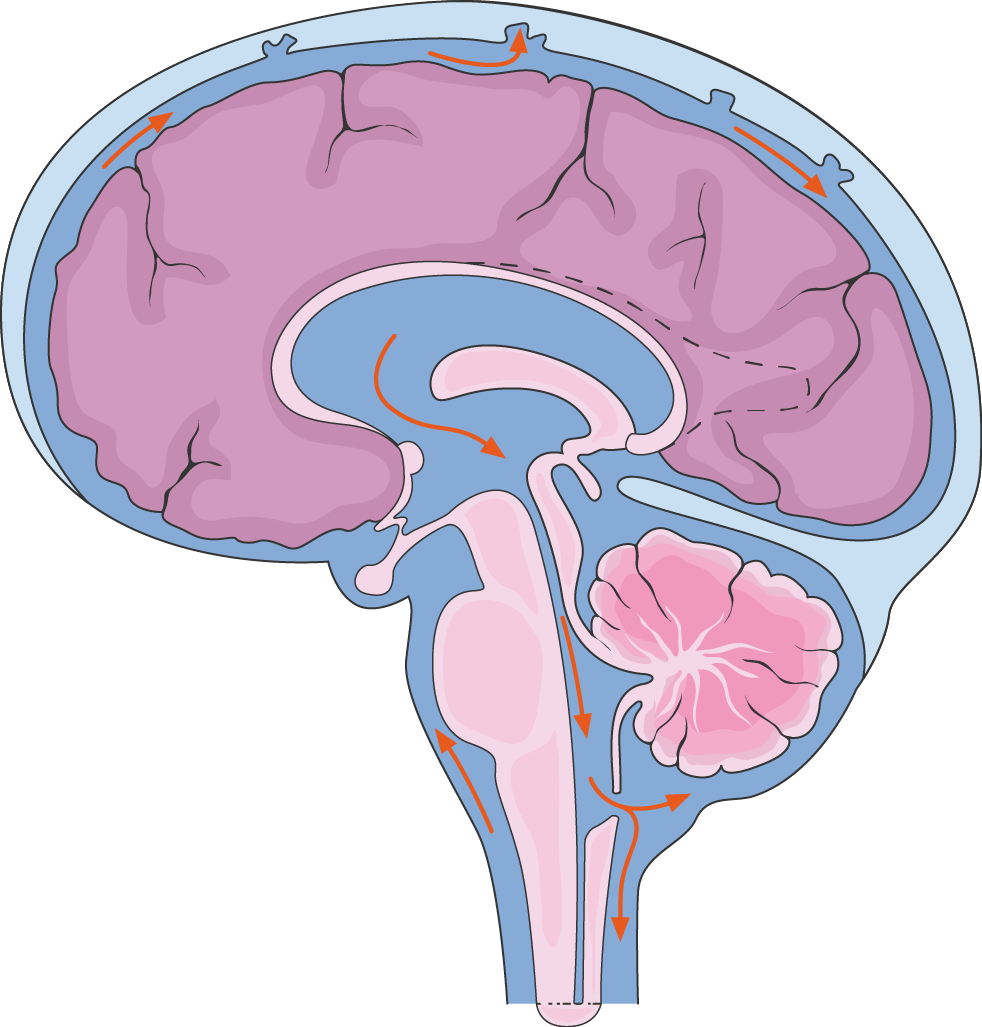 Diagram illustrating the normal flow of cerebrospinal fluid in and around the brain. 
