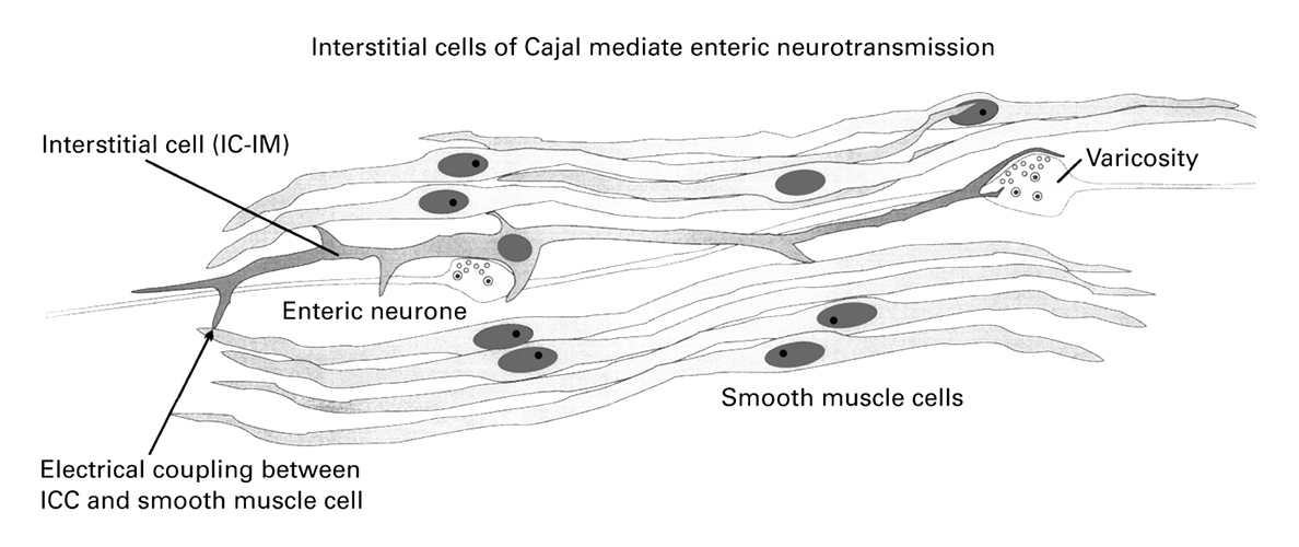 Diagram of a portion of small bowel wall showing an interstitial cell coupled with several smooth muscle cells. 