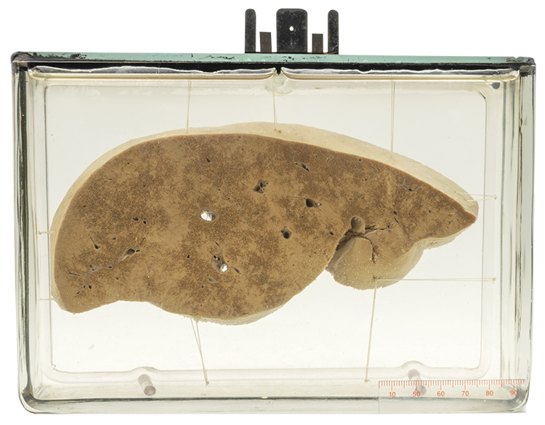 Liver