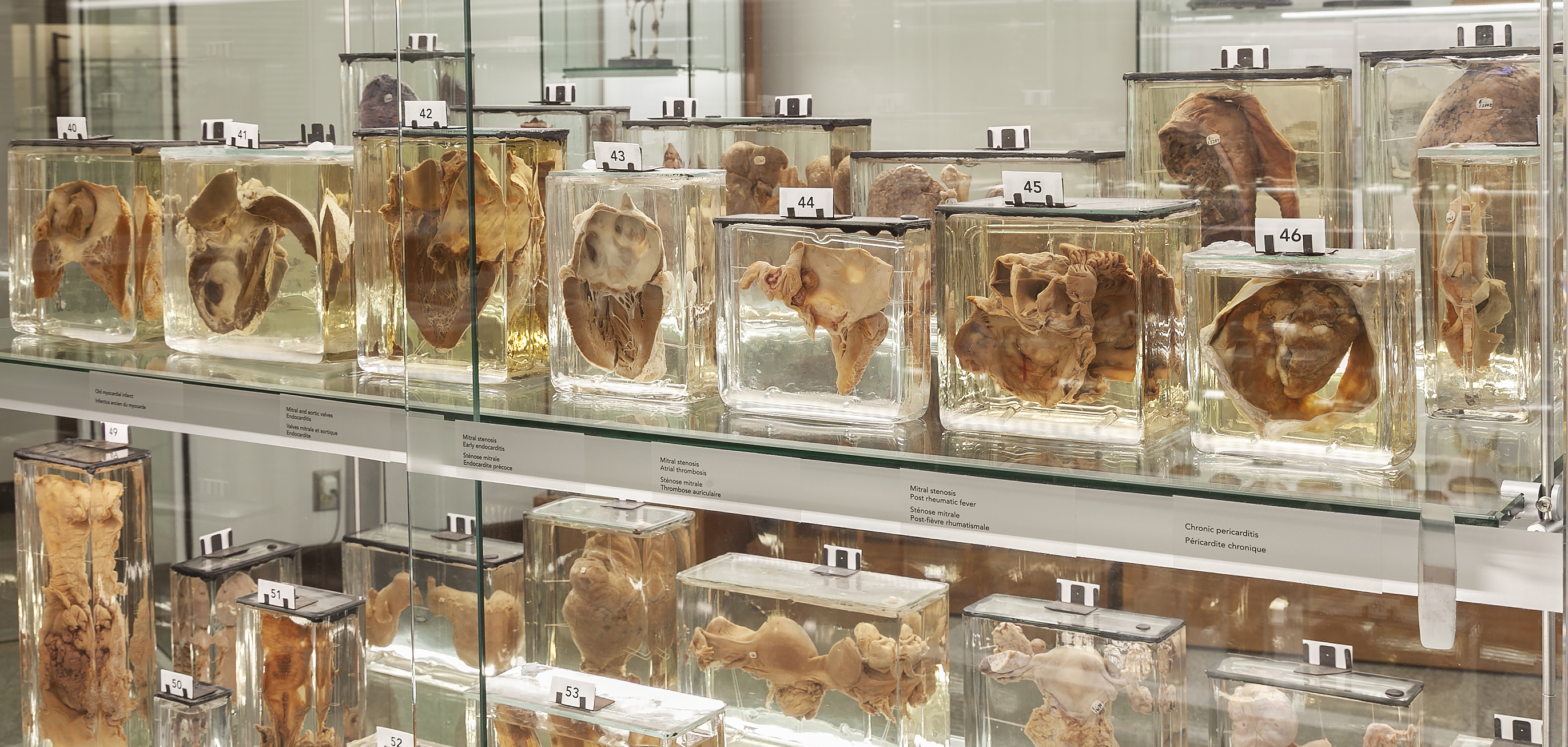 Maude Abbott Museum pathology specimen cabinet