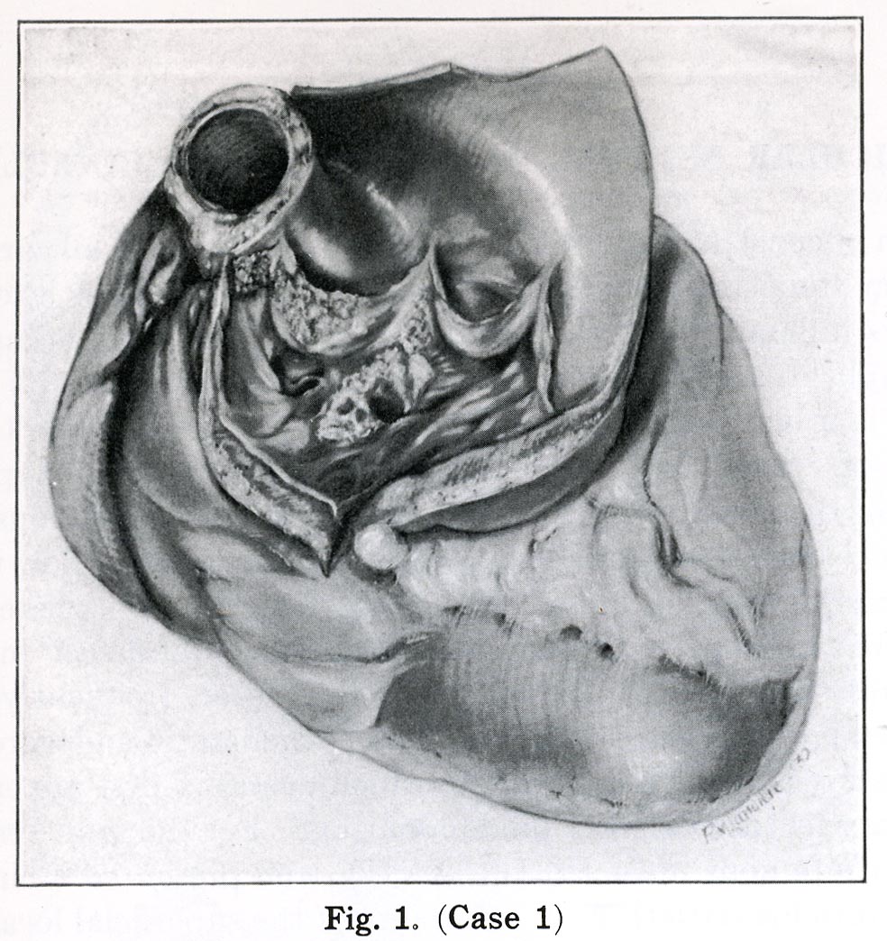 Atlas Figure 1