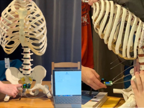 Front view of spine on left and side view of spine on right