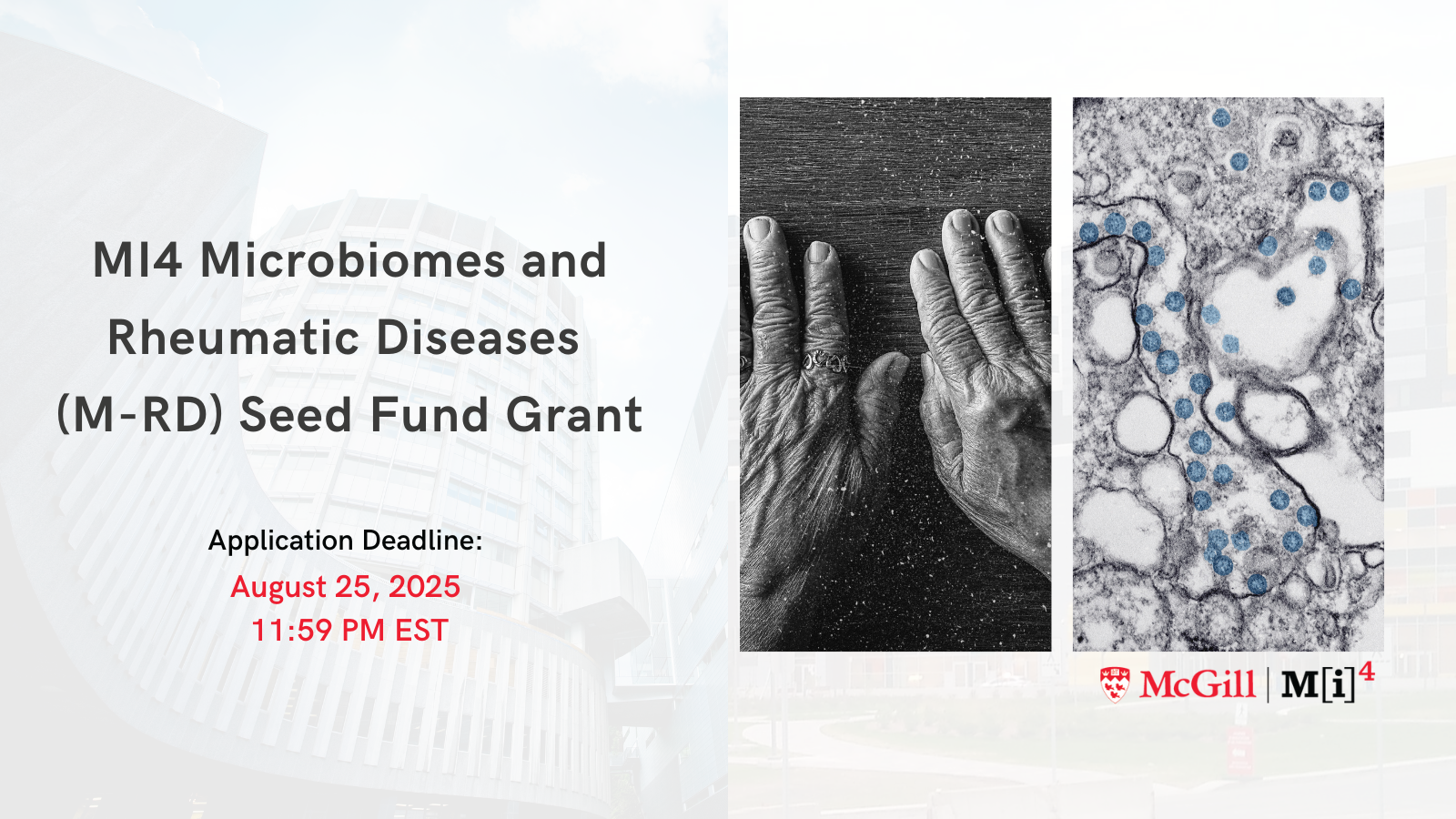 MI4 seed fund grant poster - microbiomes and rheumatic diseases competition
