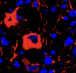 Microscopy image from Ghislaine Deyab's paper.